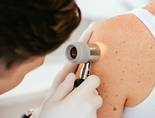 UOSD Dermatologic Oncology