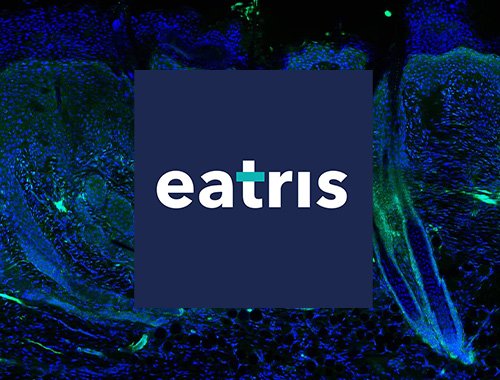 EATRIS