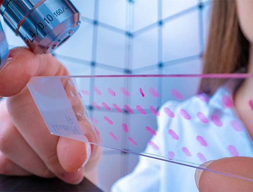 Line 1: Prevention, early detection of cancer and quality of life