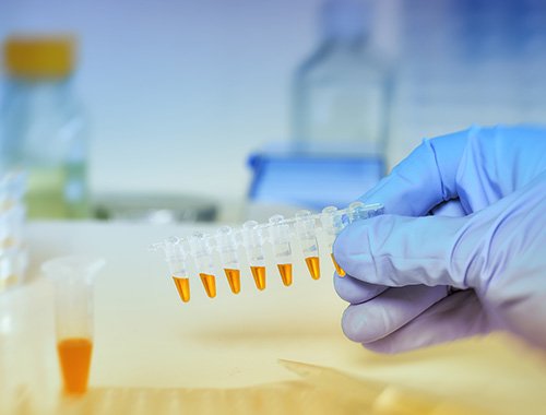 LINE 2 - SKIN CANCERS: INNOVATIVE STRATEGIES FOR PREVENTION, DIAGNOSIS AND THERAPY