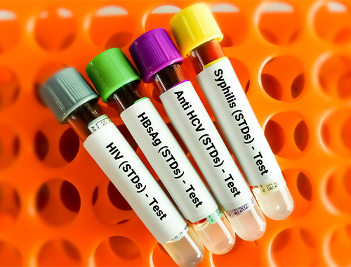 Sexually Transmitted Diseases