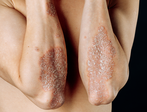 UOC Clinical Dermatology